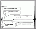 MYDIAG7.gif